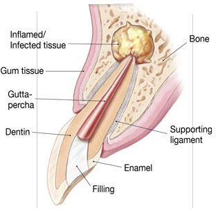 surgery1